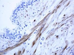 ICT1 Monoclonal Antibody (OTI2F9), TrueMAB , OriGene 100 &mu;L; Unconjugated:Antibodies,