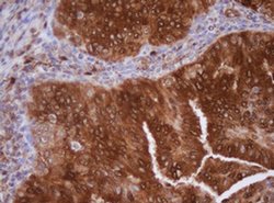 IDH1 Monoclonal Antibody (OTI24A2), TrueMAB , OriGene 100 &mu;L; Unconjugated:Antibodies,