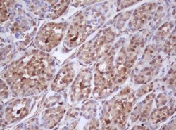 IDH1 Monoclonal Antibody (OTI1D1), TrueMAB , OriGene 30 &mu;L; Unconjugated:Antibodies,