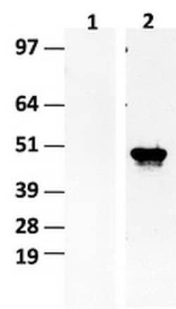 IDH1 Mouse anti-Human, HRP, Clone: OTI2H9, liquid, TrueMAB 100 &mu;L; HRP:Antibodies,