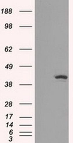 IDH1 Mouse anti-Human, Clone: OTI2H9, liquid, TrueMAB 100 &mu;L; Unconjugated:Antibodies,