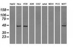 IDH1 Mouse anti-Human, Clone: OTI2H9, liquid, TrueMAB 100 &mu;L; Unconjugated:Antibodies,