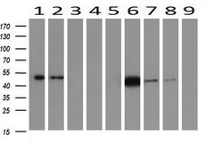IDH1 Mouse anti-Human, Clone: OTI2H9, liquid, TrueMAB 100 &mu;L; Unconjugated:Antibodies,