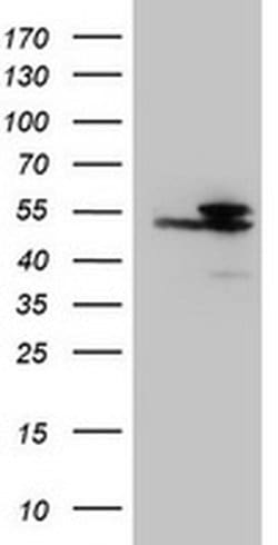 IDH1 Monoclonal Antibody (OTI24A2), TrueMAB , OriGene 100 &mu;L; Unconjugated:Antibodies,