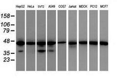 IDH1 Monoclonal Antibody (OTI24A2), TrueMAB , OriGene 100 &mu;L; Unconjugated:Antibodies,