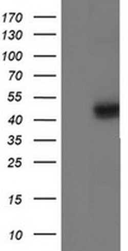 IDH1 Monoclonal Antibody (OTI1D1), TrueMAB , OriGene 30 &mu;L; Unconjugated:Antibodies,