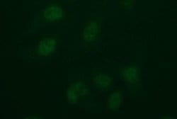 IDO2 Monoclonal Antibody (OTI2B9), TrueMAB , OriGene 100 &mu;L; Unconjugated:Antibodies,
