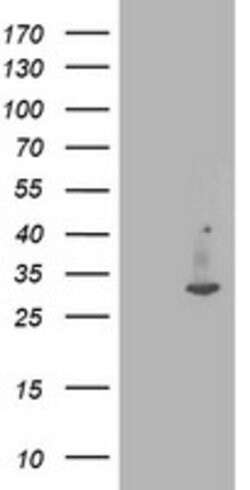 IFI35 Mouse anti-Human, Clone: OTI2B9, lyophilized, TrueMAB 100 &mu;g;