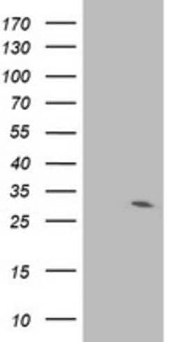 IFI35 Mouse anti-Human, Clone: OTI2G5, lyophilized, TrueMAB 100 &mu;g;