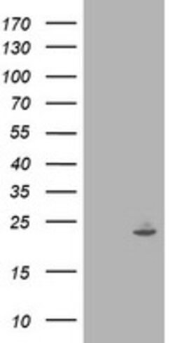 IFI35 Mouse anti-Human, Clone: OTI1C9, lyophilized, TrueMAB 100 &mu;g;