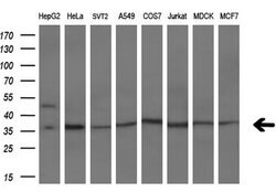 IFI35 Mouse anti-Human, Clone: OTI1C9, lyophilized, TrueMAB 100 &mu;g;