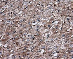 IFIT1 Mouse anti-Human, Mouse, Rat, Clone: OTI3G8, liquid, TrueMAB 100