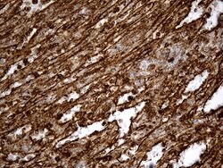IFITM2 Monoclonal Antibody (OTI2B3), TrueMAB , OriGene 100 &mu;L; Unconjugated:Antibodies,