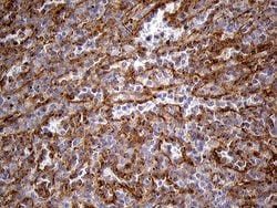 IFITM2 Monoclonal Antibody (OTI6D11), TrueMAB , OriGene 100 &mu;L; Unconjugated:Antibodies,