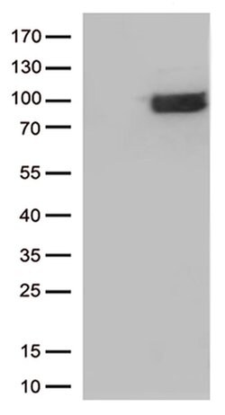 IFNLR1 Monoclonal Antibody (OTI7B2), TrueMAB , OriGene 100 &mu;L; Unconjugated:Antibodies,