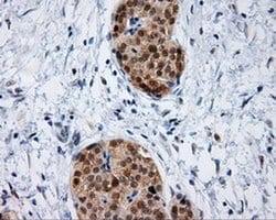IFT57 Monoclonal Antibody (OTI2G3), TrueMAB , OriGene 30 &mu;L; Unconjugated:Antibodies,