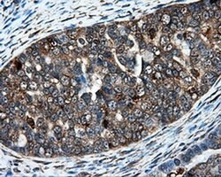 IFT57 Mouse anti-Human, Clone: OTI4F6, liquid, TrueMAB 100 &mu;L; Unconjugated:Antibodies,