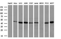 IFT57 Mouse anti-Human, Clone: OTI4F6, liquid, TrueMAB 100 &mu;L; Unconjugated:Antibodies,