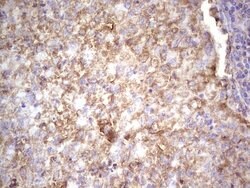 IGF1 Mouse anti-Human, Clone: OTI4B12, lyophilized, TrueMAB 100 &mu;g;