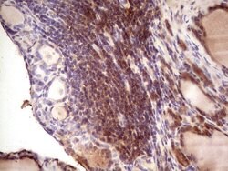 IGF1 Mouse anti-Human, Clone: OTI4B12, lyophilized, TrueMAB 100 &mu;g;