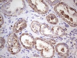 IGF1 Mouse anti-Human, Clone: OTI4B12, lyophilized, TrueMAB 100 &mu;g;