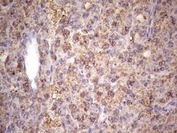IGF1 Mouse anti-Human, Clone: OTI4B12, lyophilized, TrueMAB 100 &mu;g;