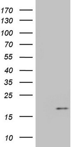 IGF1 Mouse anti-Human, Clone: OTI4B12, lyophilized, TrueMAB 100 &mu;g;