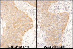 IGF2BP2 Rabbit anti-Human, Polyclonal, Bethyl Laboratories 10 &mu;L; Unconjugated:Antibodies,