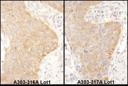 IGF2BP2 Rabbit anti-Human, Polyclonal, Bethyl Laboratories 100 &mu;L; Unconjugated:Antibodies,