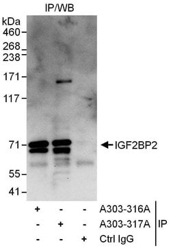 IGF2BP2 Rabbit anti-Human, Polyclonal, Bethyl Laboratories 10 &mu;L; Unconjugated:Antibodies,