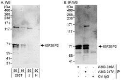 IGF2BP2 Rabbit anti-Human, Polyclonal, Bethyl Laboratories 100 &mu;L; Unconjugated:Antibodies,