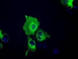 IGF2BP2 Monoclonal Antibody (OTI5G3), TrueMAB , OriGene 100 &mu;L; Unconjugated:Antibodies,