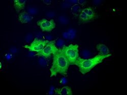 IGF2BP2 Mouse anti-Canine, Human, Clone: OTI3F9, lyophilized, TrueMAB 100