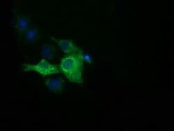 IGF2BP2 Monoclonal Antibody (OTI6C4), TrueMAB , OriGene 30 &mu;L; Unconjugated:Antibodies,