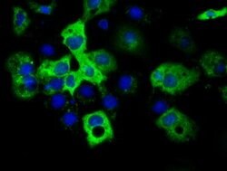 IGF2BP2 Mouse anti-Human, Clone: OTI4D10, lyophilized, TrueMAB 100 &mu;g;