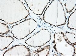 IGF2BP2 Mouse anti-Canine, Human, Clone: OTI4C4, lyophilized, TrueMAB 100