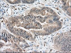 IGF2BP2 Mouse anti-Canine, Human, Clone: OTI4C4, lyophilized, TrueMAB 100