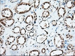 IGF2BP2 Mouse anti-Canine, Human, Clone: OTI4C4, lyophilized, TrueMAB 100