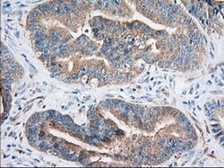 IGF2BP2 Monoclonal Antibody (OTI5G3), TrueMAB , OriGene 100 &mu;L; Unconjugated:Antibodies,
