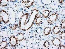 IGF2BP2 Monoclonal Antibody (OTI5G3), TrueMAB , OriGene 100 &mu;L; Unconjugated:Antibodies,