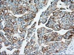 IGF2BP2 Mouse anti-Canine, Human, Clone: OTI3F9, lyophilized, TrueMAB 100
