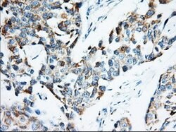 IGF2BP2 Mouse anti-Canine, Human, Clone: OTI3F9, lyophilized, TrueMAB 100