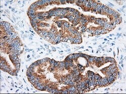 IGF2BP2 Mouse anti-Canine, Human, Clone: OTI3F9, lyophilized, TrueMAB 100