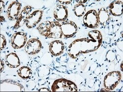 IGF2BP2 Mouse anti-Canine, Human, Clone: OTI3F9, lyophilized, TrueMAB 100