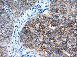 IGF2BP2 Mouse anti-Human, Clone: OTI3C8, lyophilized, TrueMAB 100 &mu;g;