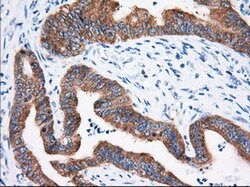 IGF2BP2 Mouse anti-Human, Clone: OTI3C8, lyophilized, TrueMAB 100 &mu;g;