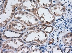 IGF2BP2 Mouse anti-Human, Clone: OTI3C8, lyophilized, TrueMAB 100 &mu;g;