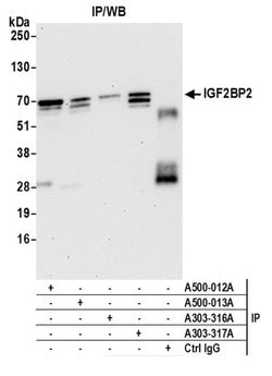 IGF2BP2 Mouse anti-Human, Mouse, Clone: 3A3.5F1, Bethyl Laboratories 100
