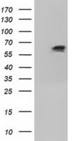 IGF2BP2 Mouse anti-Canine, Human, Clone: OTI4C4, lyophilized, TrueMAB 100