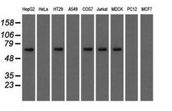 IGF2BP2 Mouse anti-Canine, Human, Clone: OTI4C4, lyophilized, TrueMAB 100